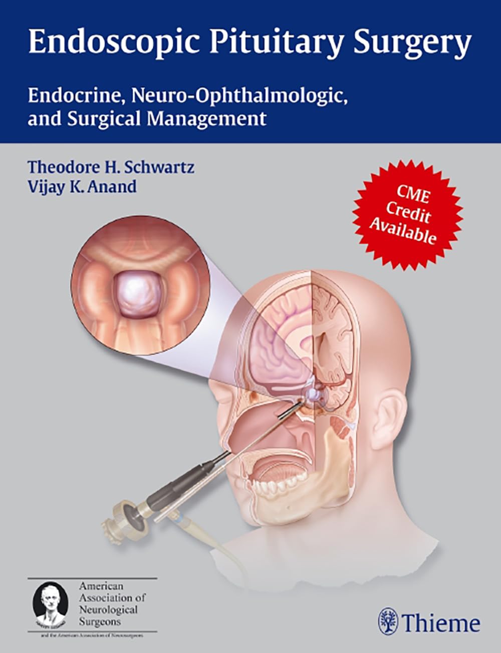 Endoscopic Pituitary Surgery: Endocrine, Neuro-Ophthalmologic and Surgical Management (English, Paperback, Theodore H. Schwartz) - Image 1 - BookBajar