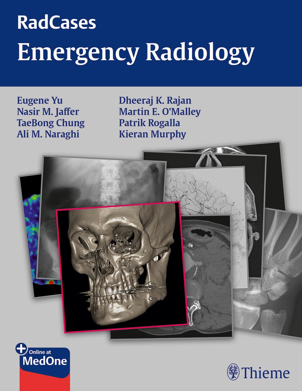 Radcases Emergency Radiology (English, Paperback, Yu, Jaffer, Chung, Naraghi, Rajan, Murphy) - Image 1 - BookBajar