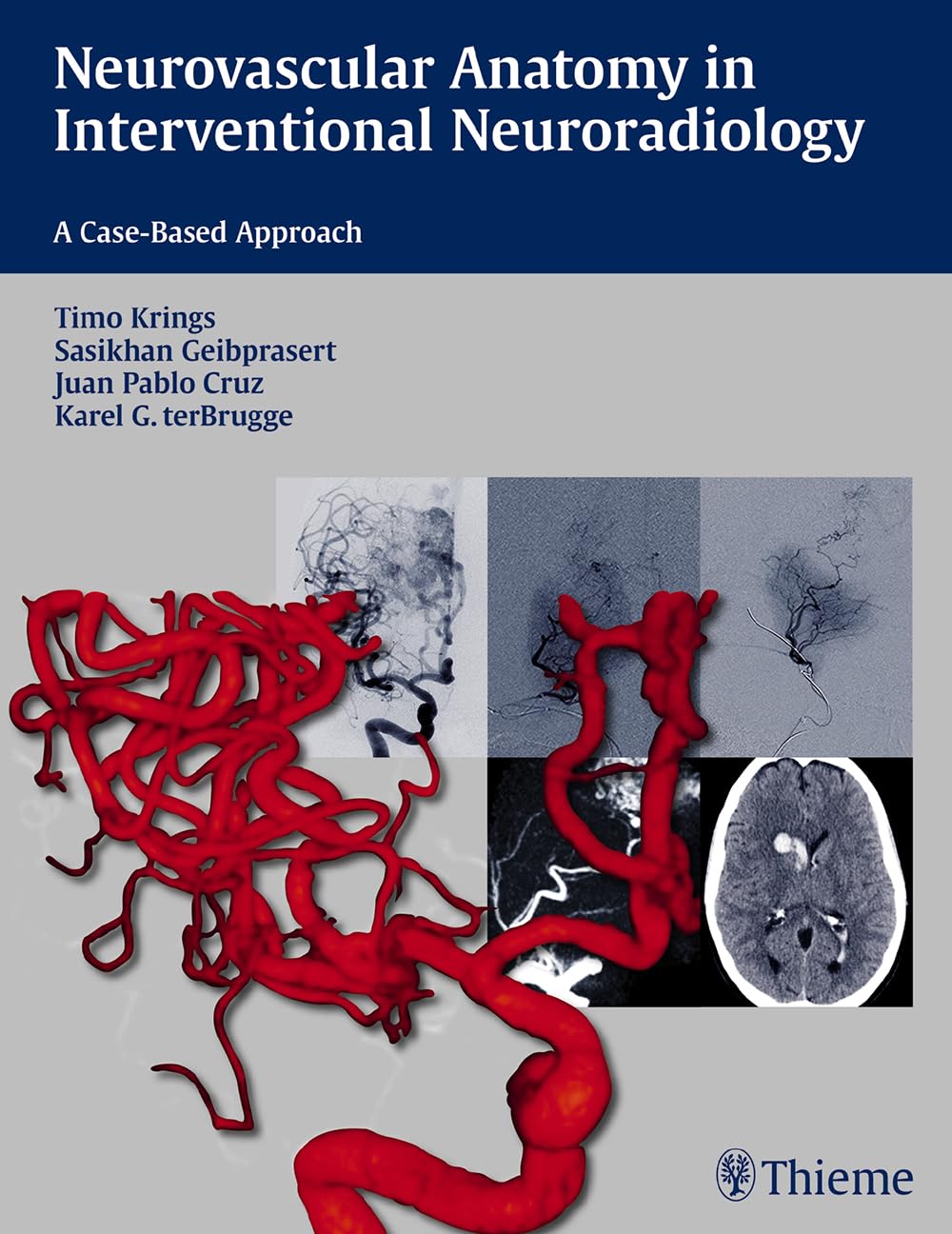 Neurovascular Anatomy in Interventional Neuroradiology (English, Paperback, Timo Krings) - Image 1 - BookBajar