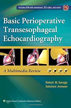 Buy Basic Perioperative Transesophageal Echocardiography: A Multimedia Review (English, Paperback, Robert M. Savage, Solomon Aronson) Online at Best Price - BookBajar