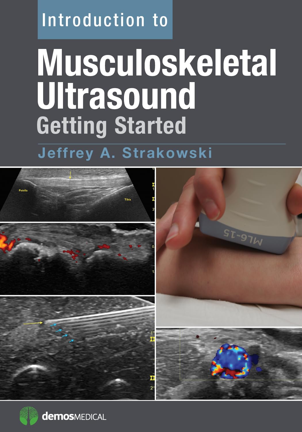 Introduction to Musculoskeletal Ultrasound: Getting Started (English, Paperback, M.D. Strakowski, Jeffrey A.) - Image 1 - BookBajar