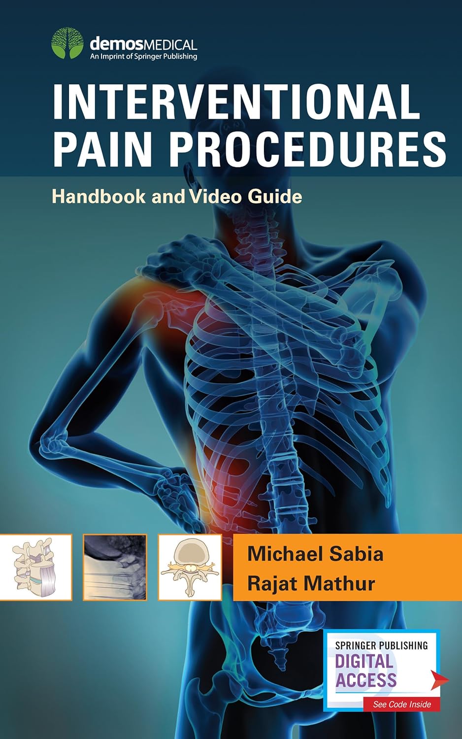 Buy Interventional Pain Procedures: Handbook and Video Guide (English, Paperback, M.d. Sabia, Michael, M.d. Mathur, Rajat) Online at Best Price - BookBajar