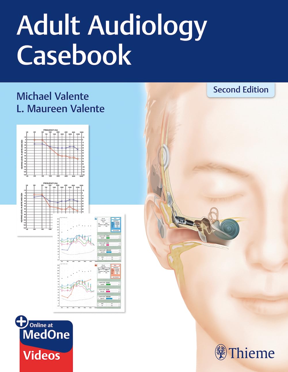 Adult Audiology Casebook (English, Paperback, Valente) - Image 1 - BookBajar