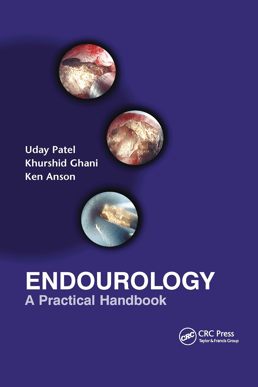 Endourology: A Practical Handbook (English, Hardcover, Uday Patel, Kenneth M. Anson, Khurshid Ghani) - Image 1 - BookBajar