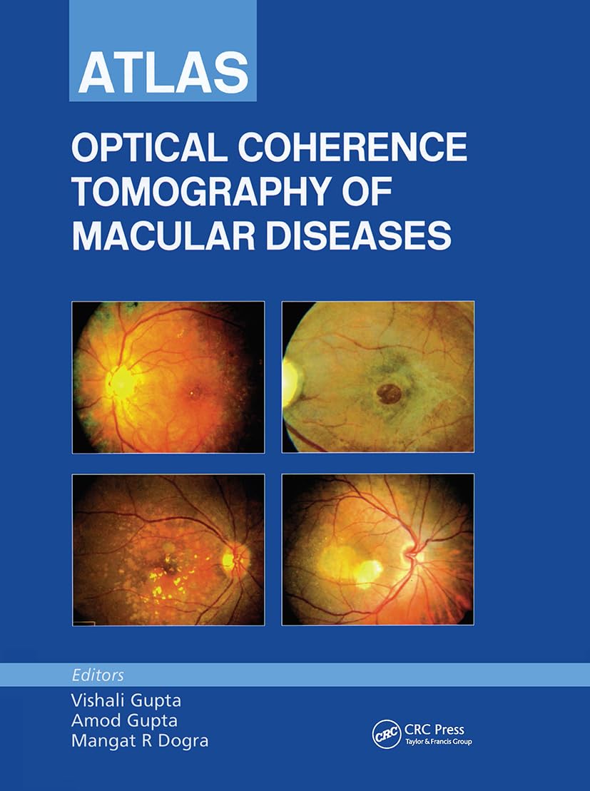 Buy (ORG)Atlas OF Optical Coherence Tomography OF Macular Diseases, 1/ED (English, Hardcover, Vishali Gupta, Amod Gupta, Mangat R. Dogra) Online at Best Price - BookBajar