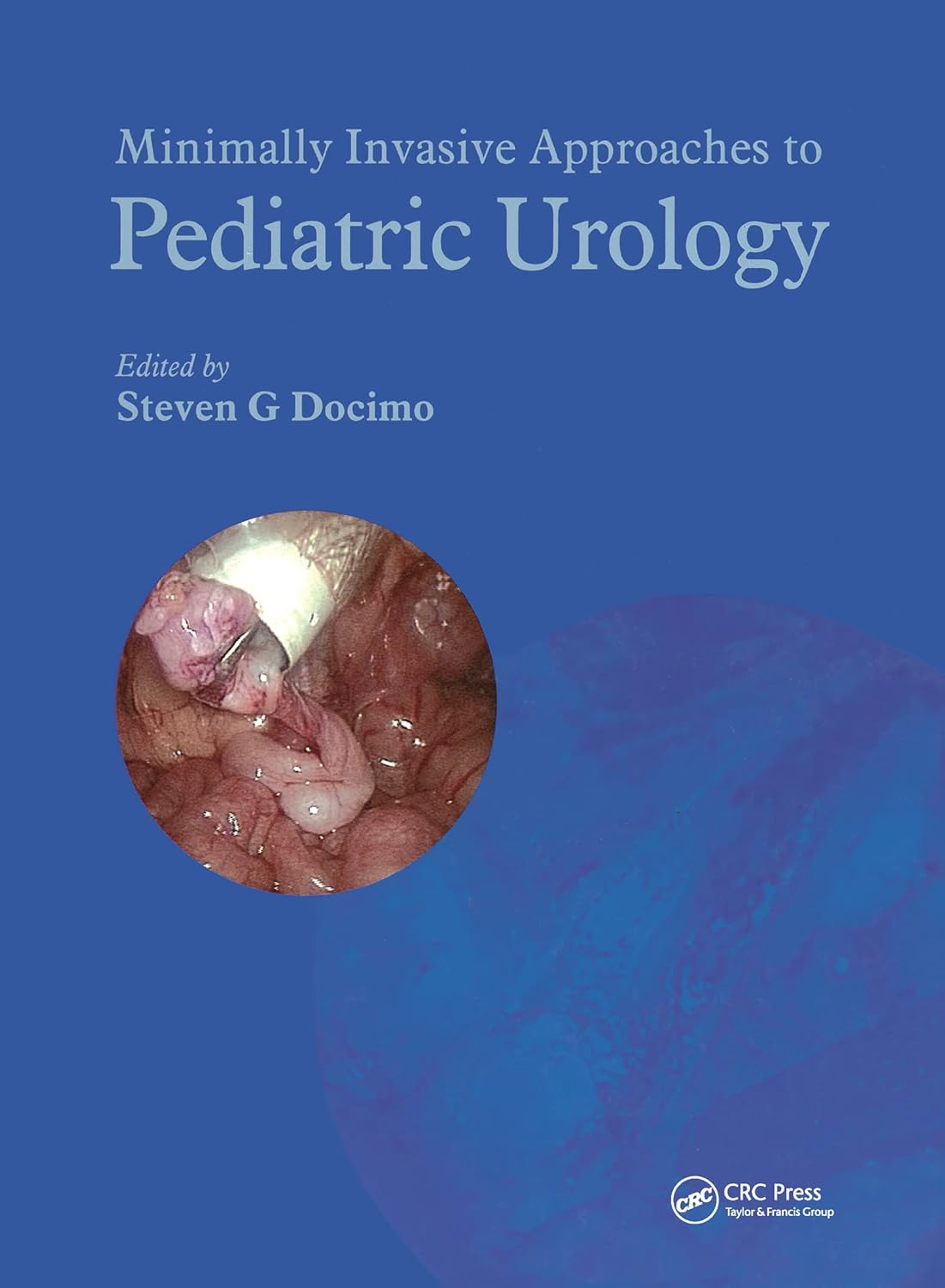Minimally Invasive Approaches To Pediatric Urology (English, Hardcover, Steven G. Docimo) - Image 1 - BookBajar