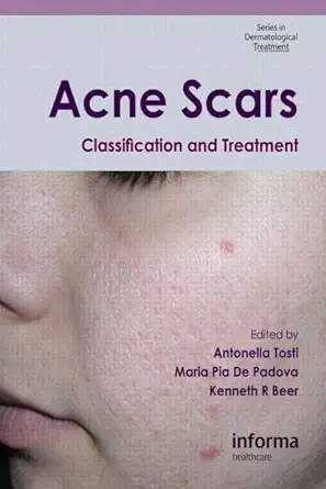 Acne Scars: Classification and Treatment: 6 (Series in Dermatological Treatment) (English, Paperback, Antonella Tosti, Maria Pia De Padova, Kenneth... - Image 1 - BookBajar