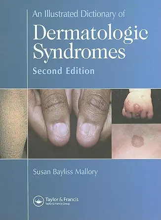 AN Illustrated Dictionary OF Dermatologic Syndromes 2/E (English, Paperback, Susan B. Mallory) - Image 1 - BookBajar