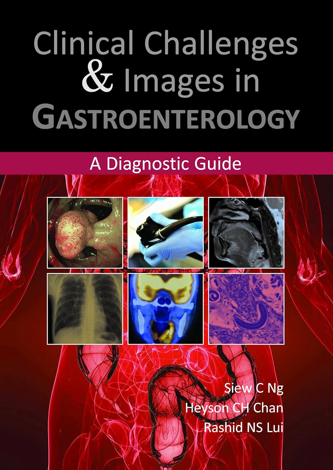 Clinical Challenges & Images in Gastroenterology: A Diagnostic Guide (English, Paperback, Siew C. Ng, Heyson C. H. Chan, Rashid N. S. Lui) - Image 1 - BookBajar