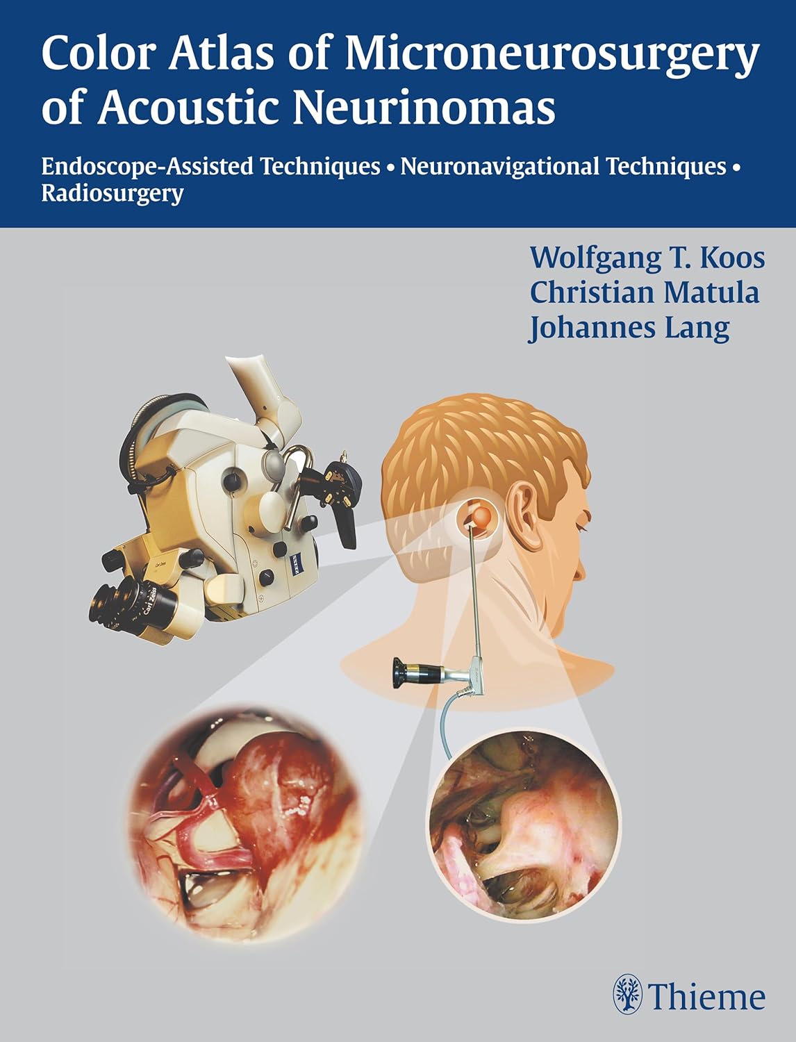 Buy Color Atlas of Microneurosurgery of Acoustic Neurinomas (English, Paperback, W. Koos) Online at Best Price - BookBajar