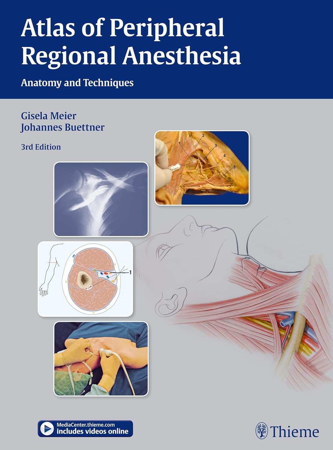 Atlas of Peripheral Regional Anesthesia: Anatomy and Techniques (English, Paperback, Gisela Meier, Johannes Buettner, Johannes Buttner) - Image 1 - BookBajar