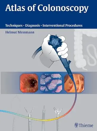 Atlas of Colonoscopy: Examination Techniques and Diagnosis (English, Paperback, Helmut Messmann) - Image 1 - BookBajar