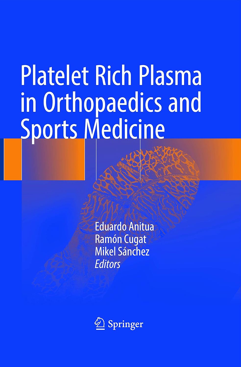 Buy Platelet Rich Plasma in Orthopaedics and Sports Medicine (English, Paperback, Eduardo Anitua, Ramón Cugat, Mikel Sánchez) Online at Best Price - BookBajar