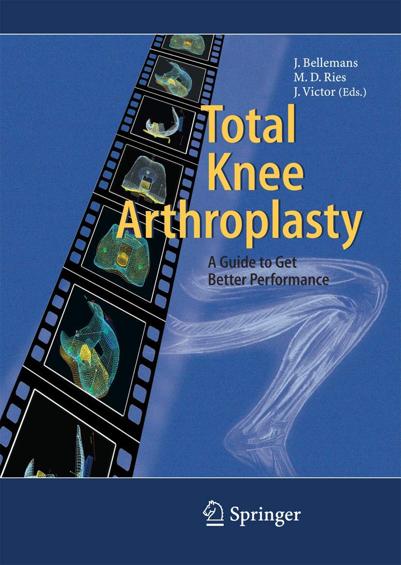 Buy Total Knee Arthroplasty: A Guide to Get Better Performance (English, Hardcover, Johan Bellemans, Michael D. Ries, Jan M.K. Victor) Online at Best Price - BookBajar