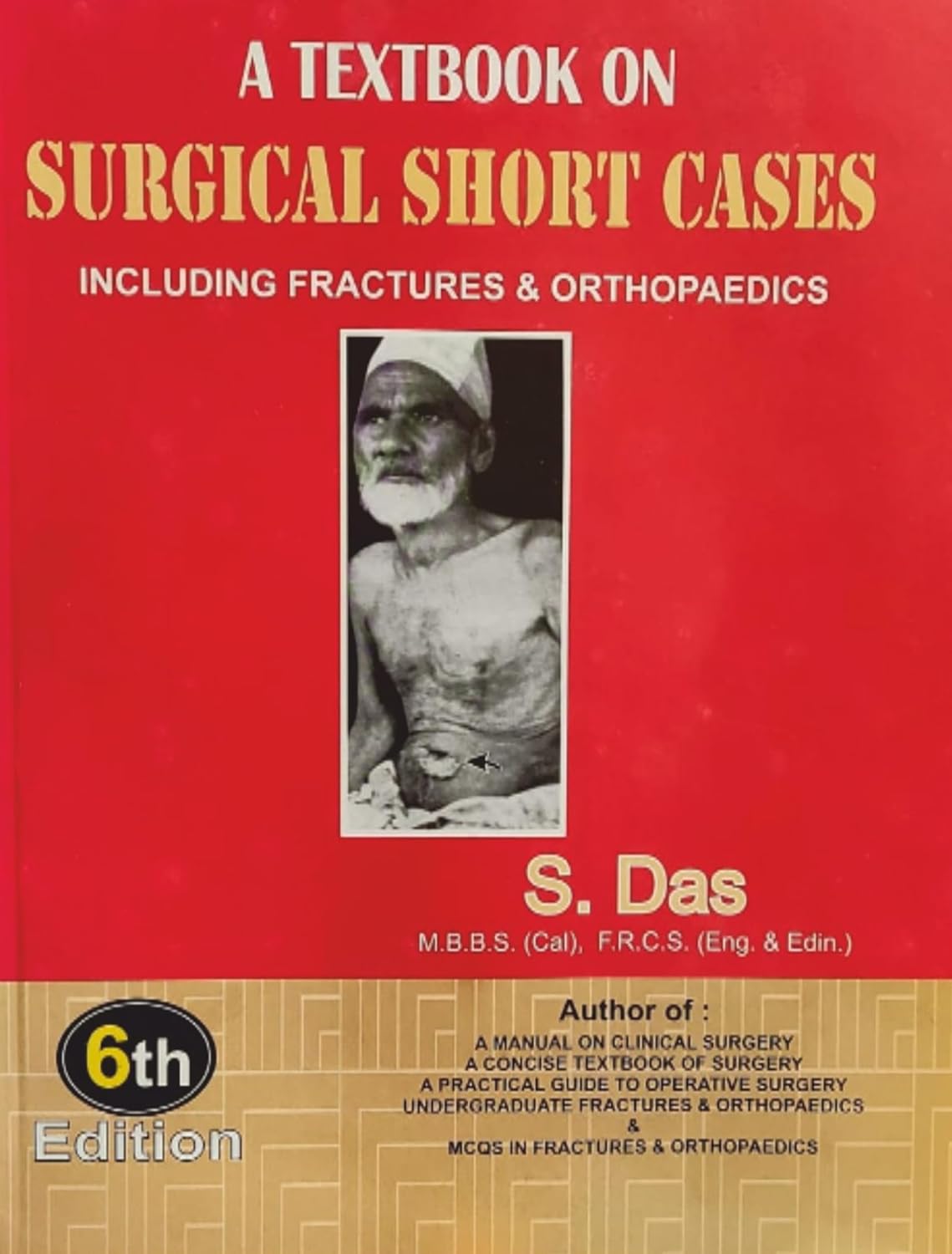 Buy A Textbook on Surgical Short Cases: Including Fractures & Orthopaedics (English, Paperback, S Das) Online at Best Price - BookBajar