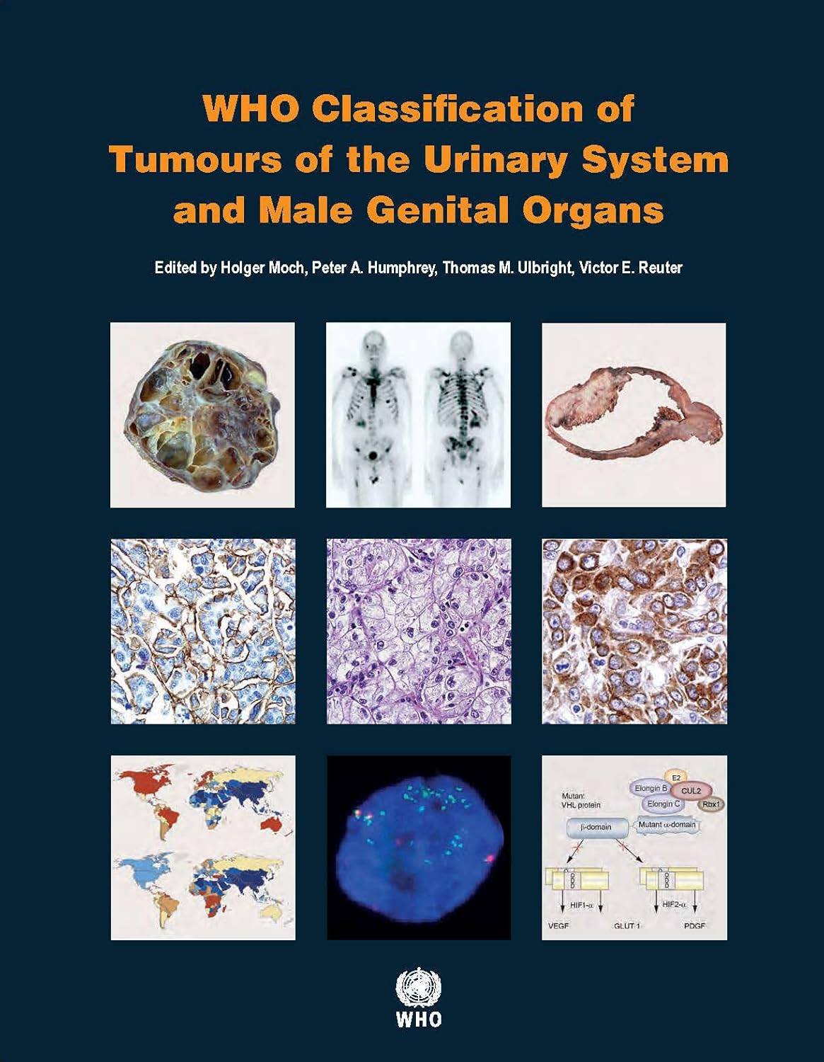 Buy WHO classification of tumours of the urinary system and male genital organs: 8 (World Health Organization Classification of Tumours) (English, Pape... Online at Best Price - BookBajar