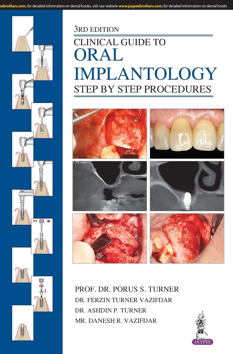 Buy Clinical Guide to Oral Implantology: Step by Step Procedures (English, Paperback, Porus S. Turner) Online at Best Price - BookBajar