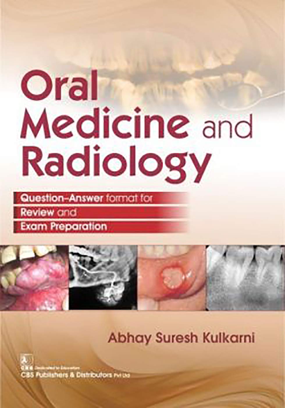 Buy Oral Medicine AND Radiology (PB 2019) (English, Paperback, Kulkarni A S) Online at Best Price - BookBajar