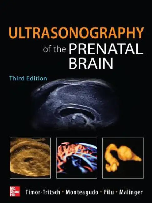 Buy Ultrasonography of the Prenatal Brain (English, Ilan Timor-Tritsch | Ana Monteagudo | Gianluigi Pilu) Online at Best Price - BookBajar