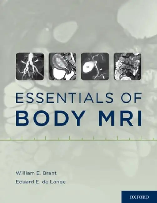 Essentials of Body MRI (English, William E. Brant | Eduard E. de Lange) - Image 1 - BookBajar
