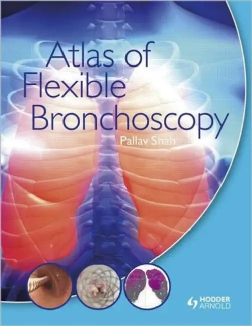 Buy Atlas of Flexible Bronchoscopy (English, Shah Pallav) Online at Best Price - BookBajar