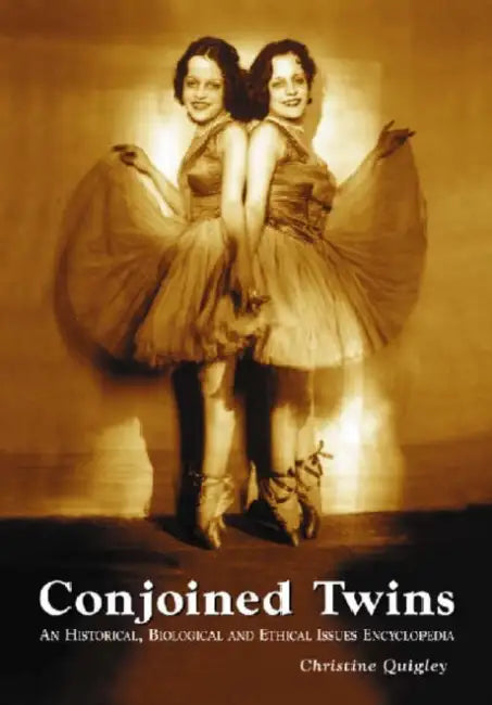 Buy Conjoined Twins (English, Christine Quigley) Online at Best Price - BookBajar