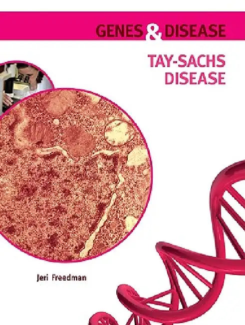 Buy Tay-Sachs Disease (English, Jeri Freedman) Online at Best Price - BookBajar