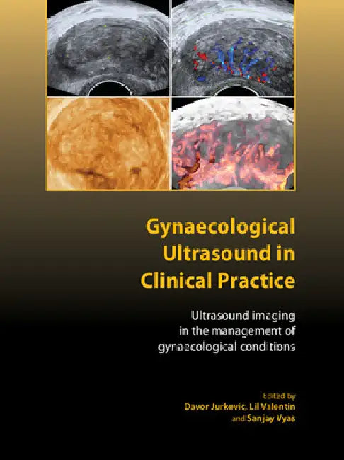 Buy Gynaecological Ultrasound in Clinical Practice (English, Davor Jurkovic | Lil Valentin | Sanjay Vyas) Online at Best Price - BookBajar