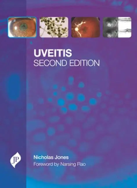 Buy Uveitis With Cd-Rom (English, Nicholas Jones) Online at Best Price - BookBajar