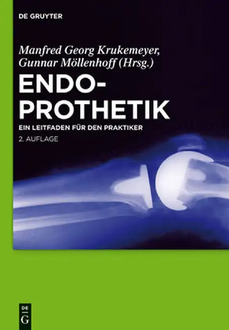Buy Endoprothetik (English, Manfred Georg Krukemeyer) Online at Best Price - BookBajar