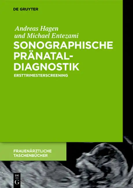 Sonographische Pränataldiagnostik (English, Andreas Hagen) - Image 1 - BookBajar