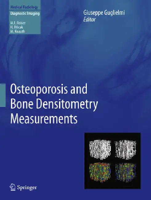 Buy Osteoporosis and Bone Densitometry Measurements (English, Giuseppe Guglielmi) Online at Best Price - BookBajar