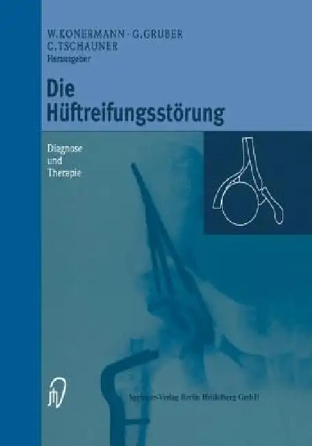 Buy Die Hüftreifungsstörung (English, Werner Konermann | Gerd Gruber | Christian Tschauner) Online at Best Price - BookBajar