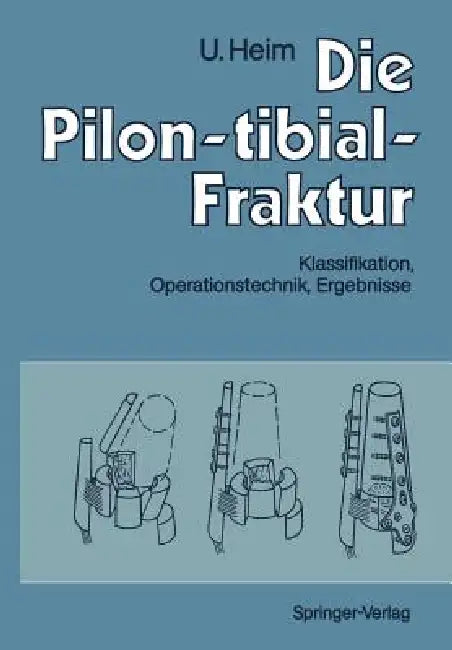 Buy Die Pilon-Tibial-Fraktur (English, A. Gächter | Urs Heim | M. Allgöwer) Online at Best Price - BookBajar
