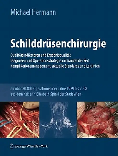 Buy Schilddrüsenchirurgie - Qualitätsindikatoren Und Ergebnisqualität, Diagnosen Und Operationsstrategie (English, Michael Hermann) Online at Best Price - BookBajar