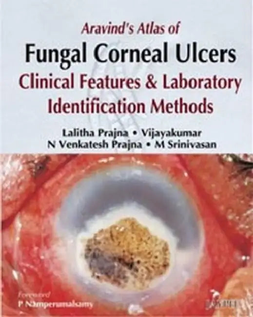 Buy Aravind's Atlas Of Fungal Corneal Ulcers Clinical Features & Lab.Identification Methods (English, Lalitha Prajna) Online at Best Price - BookBajar