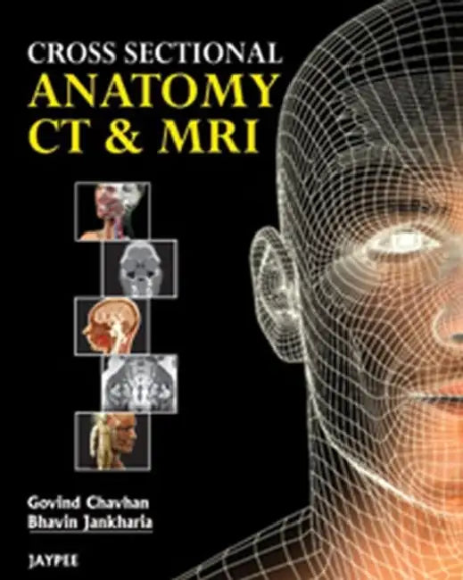 Buy Cross Sectional Anatomy Ct And Mri (English, Govind B Chavhan) Online at Best Price - BookBajar
