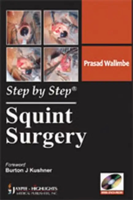 Buy Step By Step Squint Surgery (English, Prasad Walimbe) Online at Best Price - BookBajar