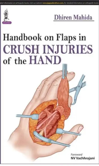 Buy Handbook On Flaps In Crush Injuries Of The Hand (English, Dhiren Mahida) Online at Best Price - BookBajar