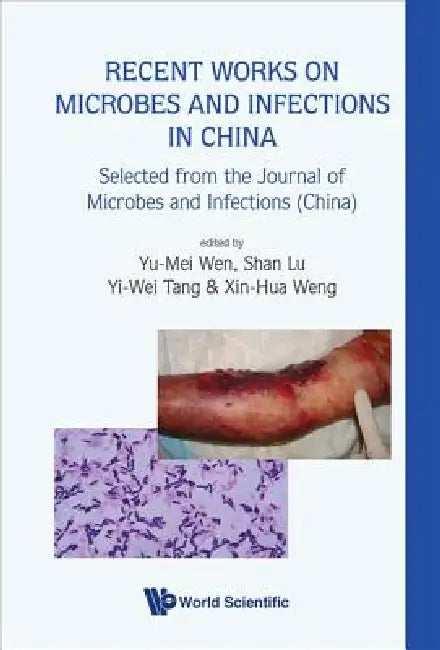 Buy Recent Works on Microbes & Infections... (English, Wen Yu-Mei) Online at Best Price - BookBajar